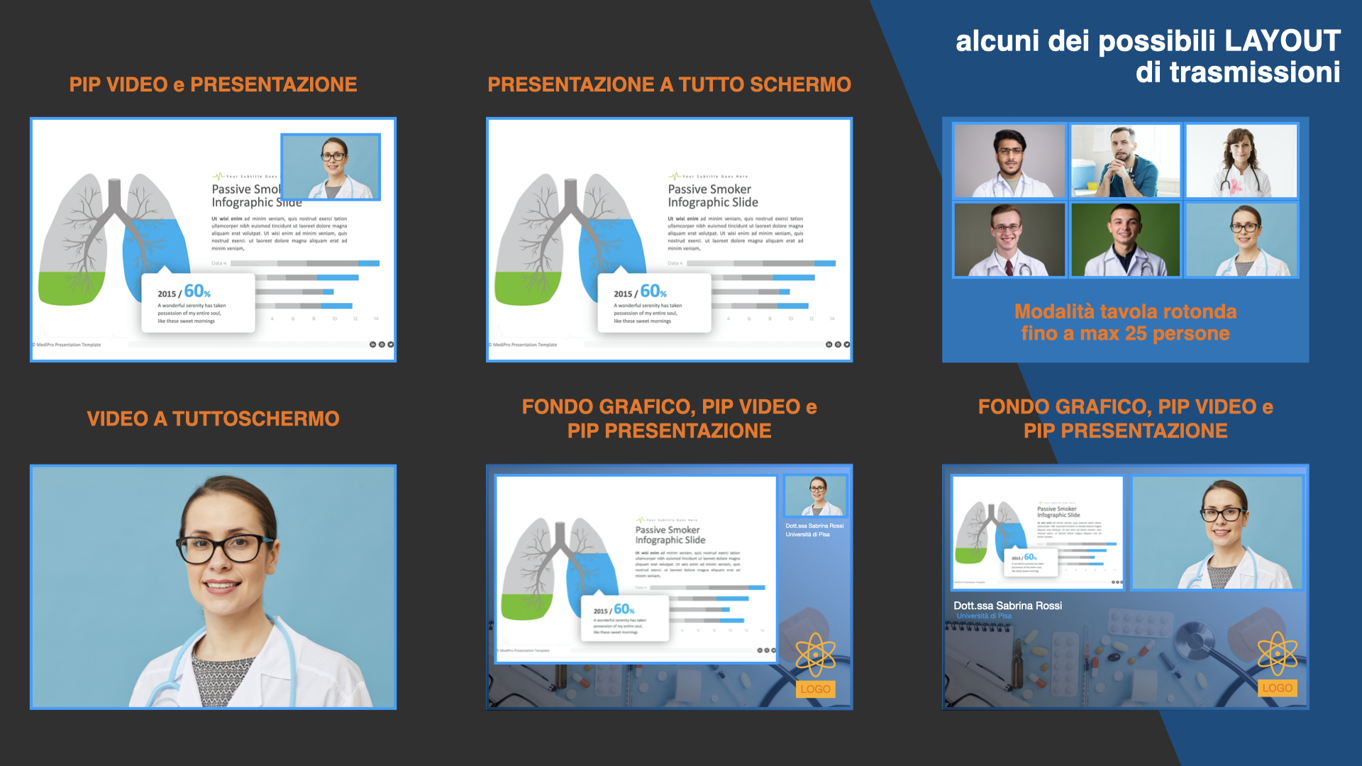  Alcuni esempi di layout di trasmissione disponibili. 